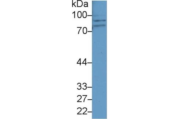 CPT1A antibody  (AA 191-353)