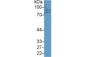 CPT1A antibody  (AA 191-353)