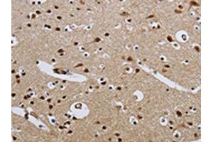 The image on the left is immunohistochemistry of paraffin-embedded Human brain tissue using ABIN7190315(CMTM8 Antibody) at dilution 1/40, on the right is treated with synthetic peptide. (CMTM8 antibody)