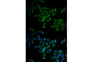 Immunofluorescence analysis of A549 cells using CASP9 antibody. (Caspase 9 antibody)