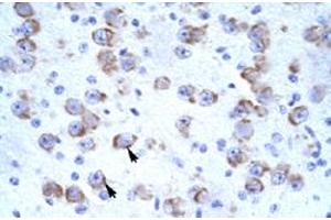 Immunohistochemical staining (Formalin-fixed paraffin-embedded sections) of human brain with CATSPER2 polyclonal antibody  at 4-8 ug/mL working concentration. (CATSPER2 antibody  (N-Term))