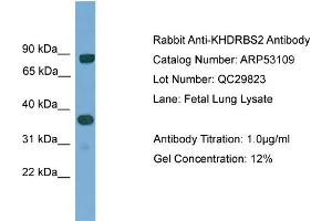 Western Blotting (WB) image for anti-KH Domain Containing, RNA Binding, Signal Transduction Associated 2 (KHDRBS2) (N-Term) antibody (ABIN2785231)