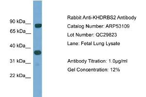 WB Suggested Anti-KHDRBS2  Antibody Titration: 0. (KHDRBS2 antibody  (N-Term))