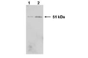 Western Blotting (WB) image for anti-Heterogeneous Nuclear Ribonucleoprotein K (HNRNPK) (C-Term) antibody (ABIN264512) (HNRNPK antibody  (C-Term))