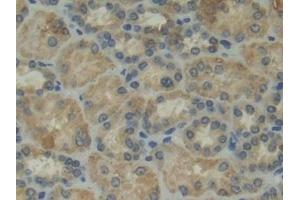 Immunohistochemistry (IHC) image for anti-Integrin alpha D (ITGAD) (AA 879-1099) antibody (ABIN7439657)