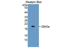 Western blot analysis of the recombinant protein. (ANGPTL2 antibody  (AA 47-207))