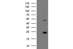 HEK293T cells were transfected with the pCMV6-ENTRY control (Left lane) or pCMV6-ENTRY EIF5A2 (Right lane) cDNA for 48 hrs and lysed. (EIF5A2 antibody)