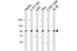 All lanes : Anti-TAF4 Antibody (C-Term) at 1:2000 dilution Lane 1: HepG2 whole cell lysate Lane 2: U-251 MG whole cell lysate Lane 3: A431 whole cell lysate Lane 4: Hela whole cell lysate Lane 5: CCRF-CEM whole cell lysate Lane 6: HL-60 whole cell lysate Lysates/proteins at 20 μg per lane. (TAF4 antibody  (AA 1021-1062))