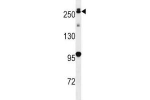 PARK8 antibody western blot analysis in mouse lung tissue lysate. (LRRK2 antibody  (AA 930-961))