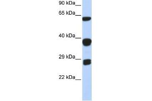 SNRPB antibody used at 1 ug/ml to detect target protein. (SNRPB antibody  (Middle Region))