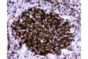 Anti-CD23 Picoband antibody,  IHC(P): Mouse Spleen Tissue (FCER2 antibody  (AA 50-331))