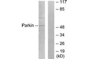 Western blot analysis of extracts from Jurkat cells, using Parkin Antibody. (Parkin antibody  (AA 1-50))