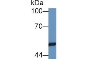 Detection of PSMC4 in Rat Testis lysate using Polyclonal Antibody to Proteasome 26S Subunit, ATPase 4 (PSMC4) (PSMC4 antibody  (AA 1-418))