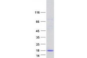 Validation with Western Blot (C2orf88 Protein (Transcript Variant 3) (Myc-DYKDDDDK Tag))