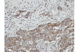 IHC-P Image Immunohistochemical analysis of paraffin-embedded N87 xenograft, using PON2, antibody at 1:100 dilution. (PON2 antibody)