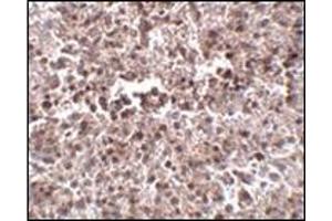 Immunohistochemistry of MettL7B in human spleen tissue with this product at 2. (METTL7B antibody  (N-Term))