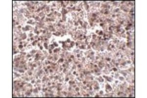 Immunohistochemistry of MettL7B in human spleen tissue with this product at 2.