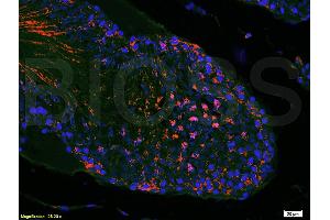 Immunofluorescence (IF) image for anti-Mechanistic Target of Rapamycin (serine/threonine Kinase) (mTOR) (AA 2436-2492) antibody (ABIN676403)