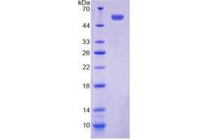 SDS-PAGE of Protein Standard from the Kit (Highly purified E. (TMEM27 ELISA Kit)