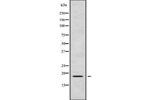 Western blot analysis of RPL24 using LOVO whole cell lysates (RPL24 antibody  (Internal Region))