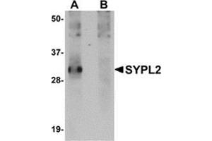 Western blot analysis of SYPL2 in human spleen tissue lysate with this product at 1 μg/ml in (A) the absence and (B) the presence of blocking peptide.