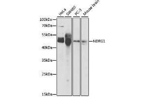 Western blot analysis of extracts of various cell lines, using NDRG1 antibody. (NDRG1 antibody  (AA 175-394))