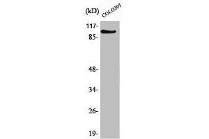 Western Blot analysis of Jurkat cells using AF-10 Polyclonal Antibody (MLLT1 antibody  (Internal Region))