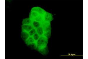 Immunofluorescence of monoclonal antibody to PIK3C2B on A-431 cell. (PIK3C2B antibody  (AA 1-110))