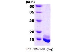 Figure annotation denotes ug of protein loaded and % gel used. (Calmodulin 2 Protein (AA 1-149))