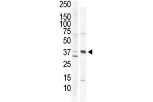 Western Blotting (WB) image for anti-Calcium/calmodulin-Dependent Protein Kinase I (CAMK1) antibody (ABIN3003045) (CAMK1 antibody)