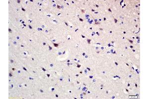 Formalin-fixed and paraffin embedded rat brain labeled with Rabbit Anti-Pumilio 1 Polyclonal Antibody, Unconjugated (ABIN1387238) at 1:200 followed by conjugation to the secondary antibody and DAB staining (PUM1 antibody  (AA 201-300))