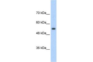 Western Blotting (WB) image for anti-Solute Carrier Family 13 Member 3 (SLC13A3) antibody (ABIN2462409)