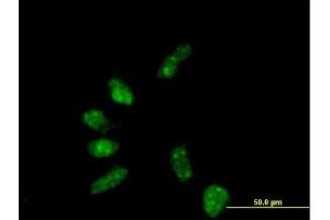 Immunofluorescence of purified MaxPab antibody to GTF2B on HeLa cell.