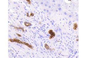 Paraformaldehyde-fixed, paraffin embedded Human liver, Antigen retrieval by boiling in sodium citrate buffer (pH6) for 15min, Block endogenous peroxidase by 3% hydrogen peroxide for 30 minutes, Blocking buffer at 37°C for 20min, Antibody incubation with Cytokeratin 19 (2F3) Monoclonal Antibody  at 1:50 overnight at 4°C, followed by a conjugated secondary and DAB staining. (Cytokeratin 19 antibody)