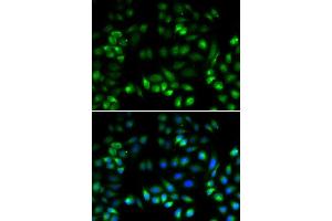Immunofluorescence analysis of U2OS cells using MANF antibody. (MANF antibody  (AA 25-182))