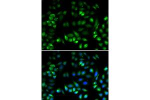 Immunofluorescence analysis of U2OS cells using MANF antibody.