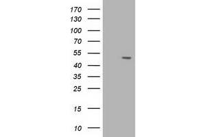 HEK293T cells were transfected with the pCMV6-ENTRY control (Left lane) or pCMV6-ENTRY AP2M1 (Right lane) cDNA for 48 hrs and lysed. (AP2M1 antibody)