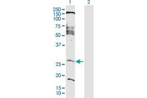 Western Blot analysis of FAM177A1 expression in transfected 293T cell line by FAM177A1 MaxPab polyclonal antibody. (FAM177A1 antibody  (AA 1-213))
