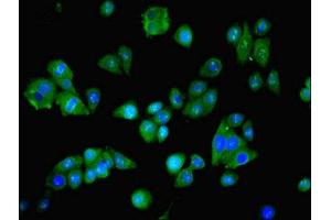 Immunofluorescent analysis of HepG2 cells using ABIN7144725 at dilution of 1:100 and Alexa Fluor 488-congugated AffiniPure Goat Anti-Rabbit IgG(H+L) (NARS antibody  (AA 1-300))