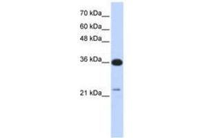 Image no. 1 for anti-TP53 Target 5 (TP53TG5) (AA 143-192) antibody (ABIN6741254) (TP53TG5 antibody  (AA 143-192))