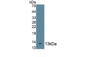 Detection of Recombinant IL8, Cattle using Polyclonal Antibody to Interleukin 8 (IL8) (IL-8 antibody  (AA 23-101))