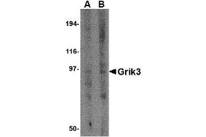 Western blot analysis of Grik3 in human brain tissue lysate with AP30383PU-N Grik3 antibody at (A) 1 and (B) 2 μg/ml. (GRIK3 antibody  (N-Term))