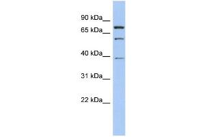 WB Suggested Anti-MOSPD2 Antibody Titration: 0. (MOSPD2 antibody  (Middle Region))