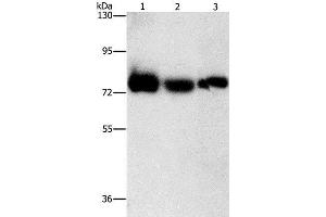 Western Blot analysis of Human fetal muscle tissue, K562 and hela cell using AMPD1 Polyclonal Antibody at dilution of 1:1600 (AMPD1 antibody)