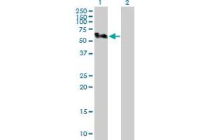 Western Blot analysis of SMU1 expression in transfected 293T cell line by SMU1 MaxPab polyclonal antibody.