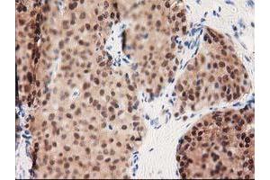 Image no. 7 for anti-UDP-Galactose-4-Epimerase (GALE) antibody (ABIN1498366)