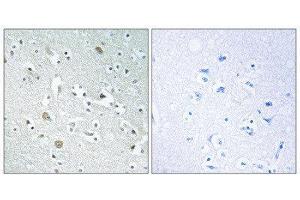 Immunohistochemistry (IHC) image for anti-Phospholipase A1 Member A (PLA1A) (C-Term) antibody (ABIN1851814)