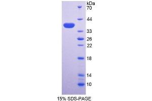SDS-PAGE (SDS) image for Alkaline Phosphatase, Liver/bone/kidney (ALPL) (AA 18-335) protein (His tag) (ABIN2120497) (ALPL Protein (AA 18-335) (His tag))
