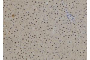ABIN6278292 at 1/100 staining Rat liver tissue by IHC-P.