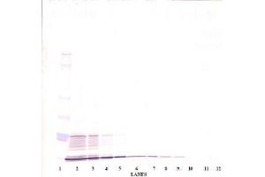 Image no. 2 for anti-Interleukin 15 (IL15) antibody (ABIN464931) (IL-15 antibody)